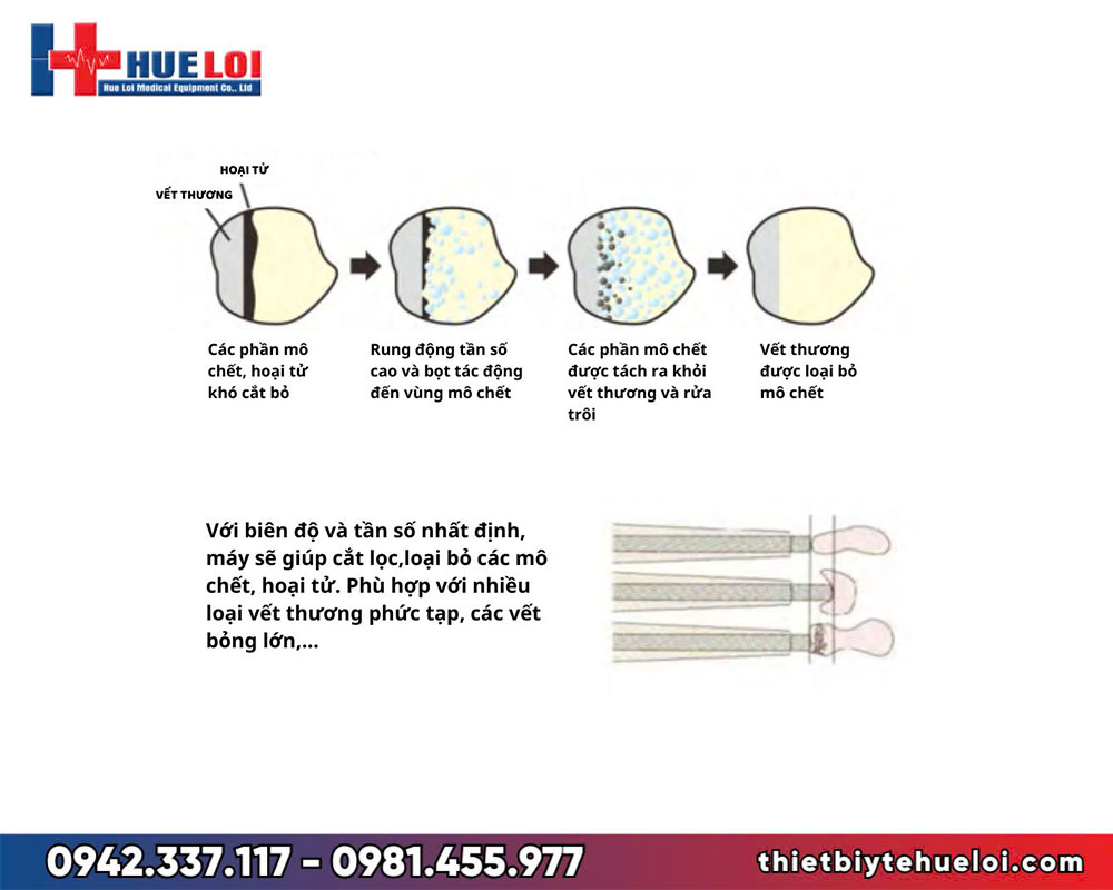 Máy điều trị vết thương bằng sóng siêu âm CareMaster